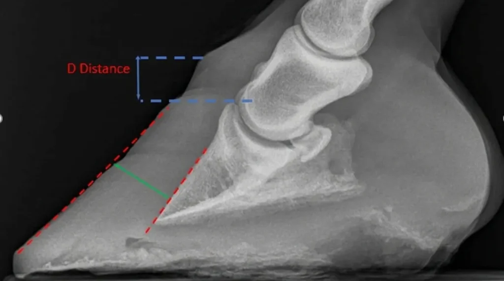 Diagnostic de la fourbure chez le cheval : examen clinique, radiographies et recherche de la cause 3 Radiographie latérale du pied montrant la position de la troisième phalange lors d’une fourbure